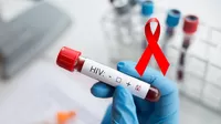 Prueba del VIH: ¿quiénes deben hacérsela y cada cuánto tiempo?