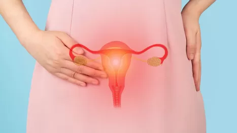 Una mujer con diagnóstico de ovario poliquístico, ¿tiene quistes?