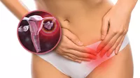 ¿En qué casos los quistes en el ovario producen dolor?