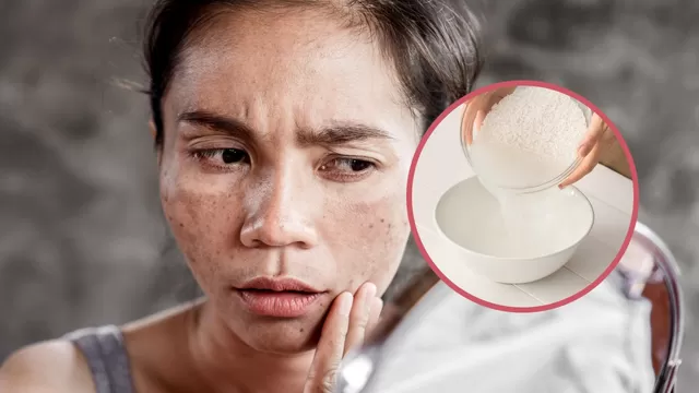 El ingrediente del arroz que puede atenuar las manchas del rostro