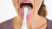 ¿Por qué mi lengua se pone blanca pese a que la limpio o cepillo?