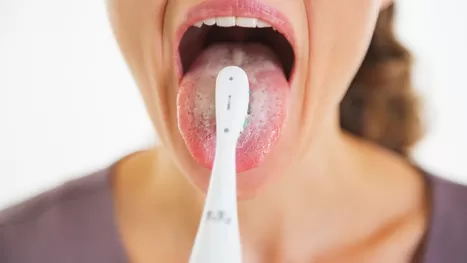 ¿Por qué mi lengua se pone blanca pese a que la limpias o cepillas?