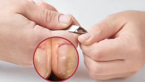 ¿Por qué no debes quitarte la cutícula de las uñas?