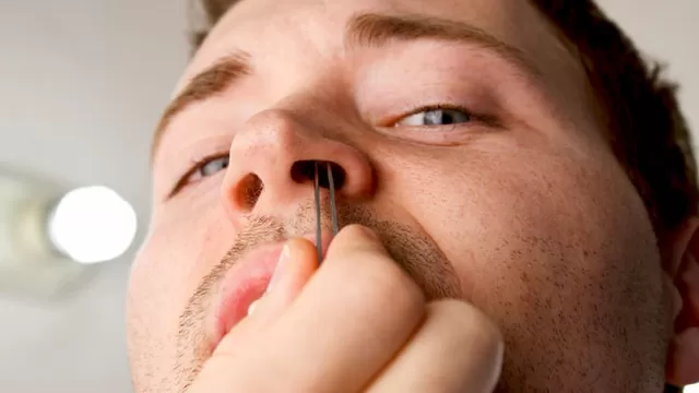 Los pelos de la nariz cumple una función vital en el organismo. 