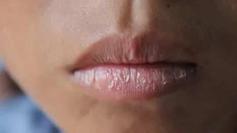 ¿Qué productos usar para reparar e hidratar tus labios resecos?