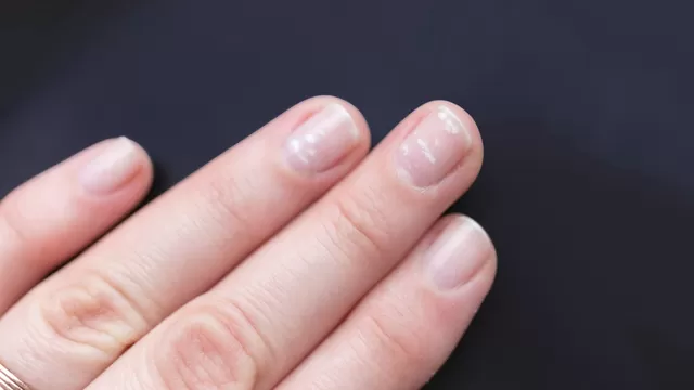 Lo que debes evitar para no tener manchitas blancas en tus uñas