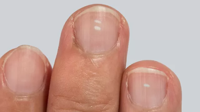 Conoce el significado de las manchas blancas en tus uñas