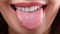 ¿Por qué tu lengua se pone blanca y qué debes hacer?