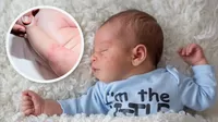 Sarpullido en bebés: causas y cómo tratarlo en casa de forma rápida