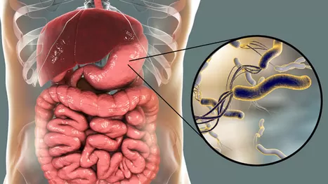 Helicobacter pylori: ¿cómo se transmite y cuáles son los síntomas?