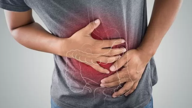 Lo que debes saber sobre el cáncer de colon