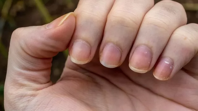 Las causas por las que las uñas lucen amarillas